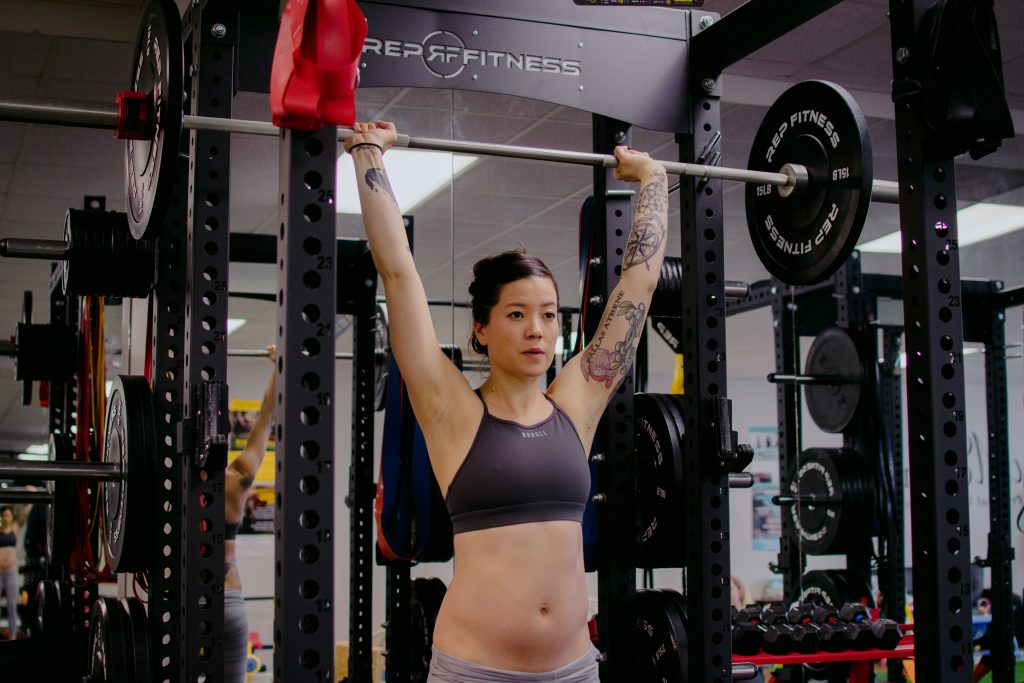 Diastasis Coning