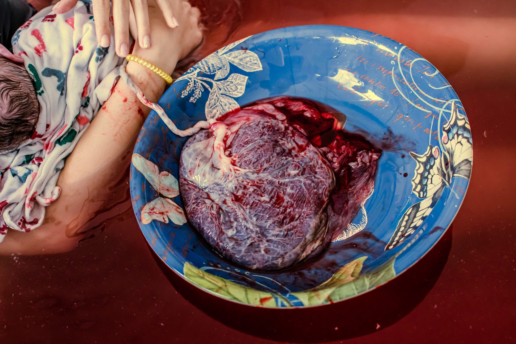 Placenta locations: Front, Back, or Down Below? Delayed Cord Clamping