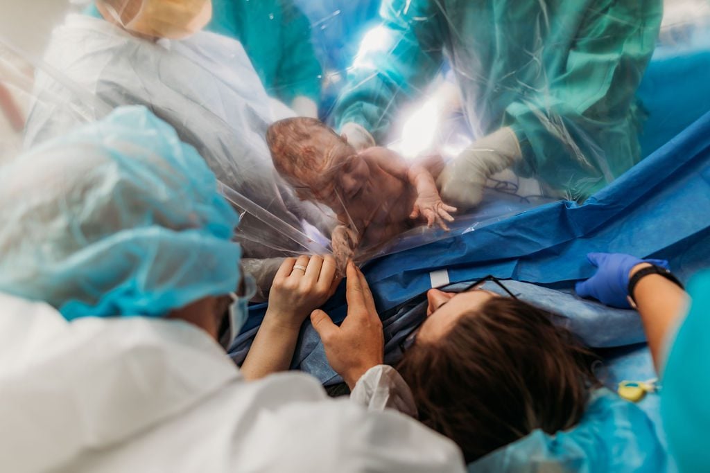 Cesarean Birth Preparation: Top 6 Prenatal Exercises To Prepare For A C-Section